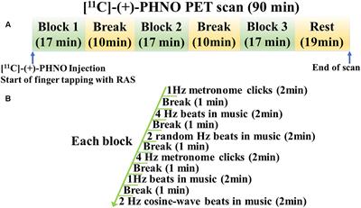 Motor Synchronization to Rhythmic Auditory Stimulation (RAS) Attenuates Dopaminergic Responses in Ventral Striatum in Young Healthy Adults: [11C]-(+)-PHNO PET Study